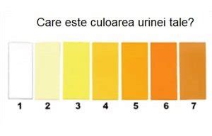 urină portocalie|8 tipuri de urină care indică starea de sănătate